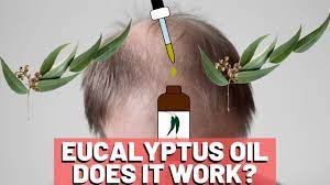 Eucalyptus oil is both a prevention and a cure for dandruff. Eucalyptus Oil For Hair Growth Does It Help Youtube