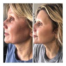 Le Cera Boutique Waxing Studio, 11909 Preston Rd, Ste 1436, Dallas, TX  75230, US