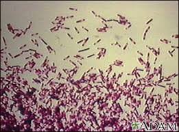 Under certain conditions, these organisms may grow in foods. Clostridium Difficile Organism Medlineplus Medical Encyclopedia Image