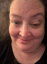 Poet taking break after laser eye surgery