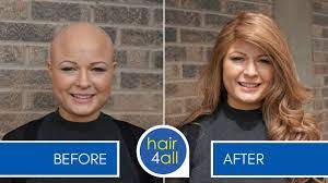 How To Apply Attach A Non Surgical Hair Replacement System For Women With Hettie Youtube