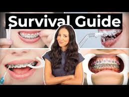 It'S Not Easy Being A Teenager With Braces | Tony Weir Orthodontics