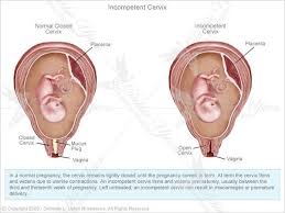 Your cervix will be just slightly open just before ovulation. What Is The Function Of The Cervix Quora
