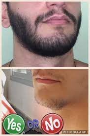 Yes to all, i don't really have a preference, tho i don't really have experience with guys with facial hair. My More Or Less 1 5 Year Minox Journey Ignore The Yes Or No Snapchat Filter Minoxbeards