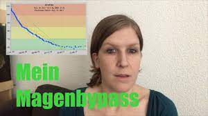 Mein Magenbypass Gewichtszunahme Nach Op Youtube