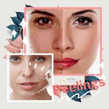 TIENES OJERAS? 🐼 La hipercromía idiopática del anillo orbitario, conocida  como #ojeras, o círculos negros debajo los ojos son alteraciones de la  coloración de la piel debido a una producción excesiva de