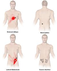 Side muscles of the torso external. The Internal And External Oblique Muscles Its Attachments And Actions