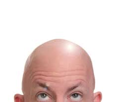 Being Bald Is Ok Bald Person Scalps Balding