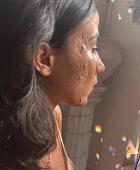 Maia Gray (@its_just_acne) • Threads, Say more