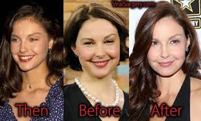 The actress started trending on twitter because of comments about her face stemming from a video posted by elizabeth warren's campaign. Ashley Judd Plastic Surgery Before After Ashleyjudd Hollywood Celebrity Plasticsurgery Celebritypla Plastic Surgery Celebrity Plastic Surgery Ashley Judd