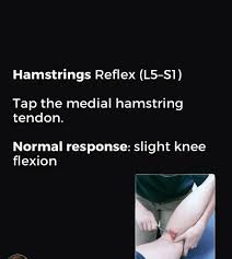Image result for Supinator Reflex
