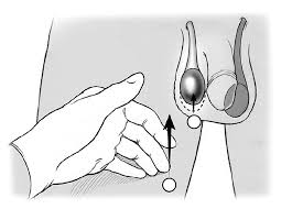 Image result for Cremasteric Reflex