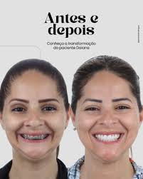 Bucomaxilo em Salvador