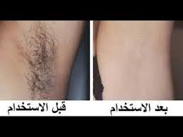ازالة شعر الوجه خلطة طبيعية لتخفيف نمو الشعر ازالة الشعر من الوجه افضل طريقة لازالة الشعر Beauty Skin Care Routine Beauty Care Beauty Skin