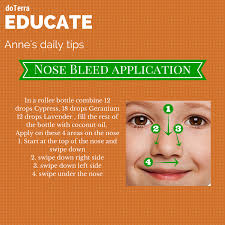 Nose Bleed Application Doterra Nosebleeds Http Aromaticsciencemadesimple Blogspot Essential Oils For Kids Essential Oils Health Essential Oils Aromatherapy