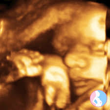 Wann ist die beste zeit für einen 3d ultraschall? Ultraschall 3d Kaufbeuren Mudr Peter Mydla