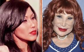 Aug 13, 2021 · fotos de lyn may antes y después de la cirugía estética que le arruinó la vida. 2irnatrgtoawcm