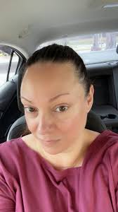 Results of using skincare product