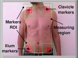 Chest pain protocols part ii. Detection Region Of Interest Roi And Measuring Area On The Patient S Download Scientific Diagram