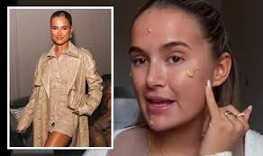 Molly-Mae Hague: Love Island star has 'full beard' after dermaplaning  treatment