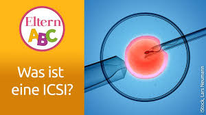 Wann findet die #einnistung des embryos in die gebärmutter statt? Icsi Ablauf Chancen Risiken Und Kosten Eltern De