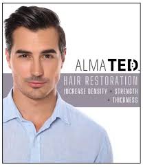 Hair Restoration Rancho Cucamonga, Redlands, Hesperia