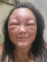 Bee gloves not sting proof for beekeepers