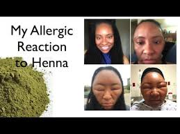 You cannot dye hair black with natural henna dye. My Allergic Reaction To Henna Henna Hair Dyes Henna Natural Hair Henna Hair
