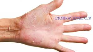 Cuci tangan yang benar dengan sabun mampu membersihkan tangan dengan membunuh kuman secara efektif. Sabun Cuci Pinggan Untuk Kulit Sensitif Yang Sangat Lembut Pada Tangan Berkesan Menjimatkan Ohcantik Com