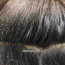 You've heard that lice like clean hair better than dirty and oily hair. Does Your Client Have Lice This Is What To Do Behindthechair Com