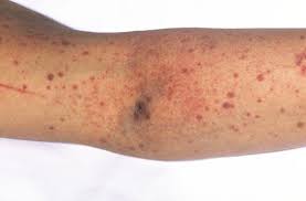 trombosit ozellikleri ve faydalari