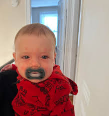 Baby allergic reaction to egg?