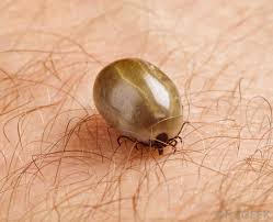 The general goal is to keep ticks from coming into your yard, by restricting animals that carry ticks (such as deer) or by applying pesticides along the yard perimeter. What Is Tick Fever With Pictures