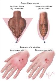 Snakes are common on all continents of the globe. Snakebite Survival Skills Survival Tips Wilderness Survival Skills