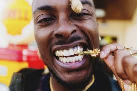 Tendance. Strass, grillz… Les bijoux de bouche font saliver les jeunes