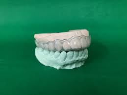 Image result for Occlusal