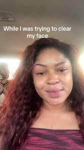 Effective Hyperpigmentation Treatments with Veet Gold Products