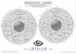 What Is Iridology Diagnosis Chart Iriscope Iridology