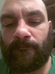 I'm new to this group, is this a safe space to talk about beard health?