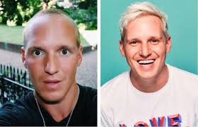 Jamie Laing Hair Transplant: Everything You Need To Know