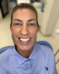 Mnogo smo sretni kada dodjete u ordinaciju jer ste kod nekoga vidjeli naš  Dentalist Osmijeh i poželjeli isti i za sebe... baš tako je bilo i sa našom  dragom Janjom 🤍