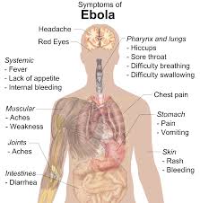 Lesen sie jetzt alles über symptome, ursachen und mehr! Ebola Facharztwissen