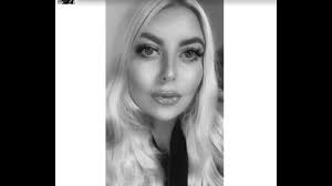 Turcja. Brytyjka Shannon Bowe chciała schudnąć. Zmarła podczas implantacji  opaski żołądkowej