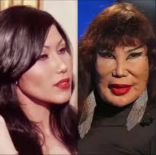 Lyn May And Her Tragic Story That Changed Her Appearance