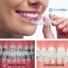How Do Regular Dental Braces Cost Teeth Straightening Invisible Braces Braces Cost