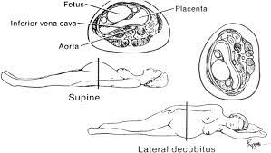 Figure 4 From Physiologic Changes During Normal Pregnancy And Delivery Semantic Scholar