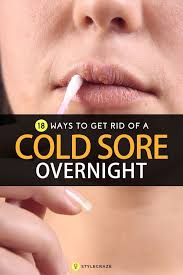 A Cold Sore Is Also Referred To As A Fever Blister Where You Get Or Develop Small Lesions That Look Like Blis Cold Sore Remedy Overnight Cold Sore Canker Sore