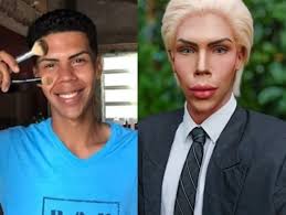 Jovem desiste de parecer "Ken humano" após planejar 42 cirurgias |