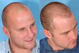 Hair Loss Treatment Center