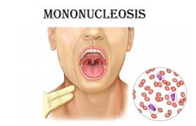 Lots of people carry the virus but. Pin On Health